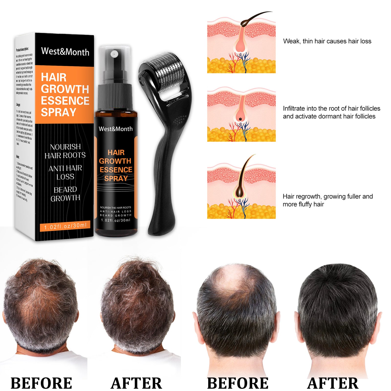 Roller + Hair Growth Spray Nourishing Liquid