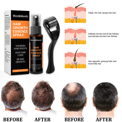 Roller + Hair Growth Spray Nourishing Liquid